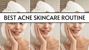 best acne skincare routine