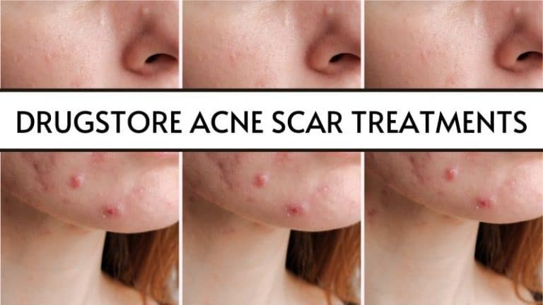 13 BEST Drugstore Acne Scar Products that’ll Definitely Help