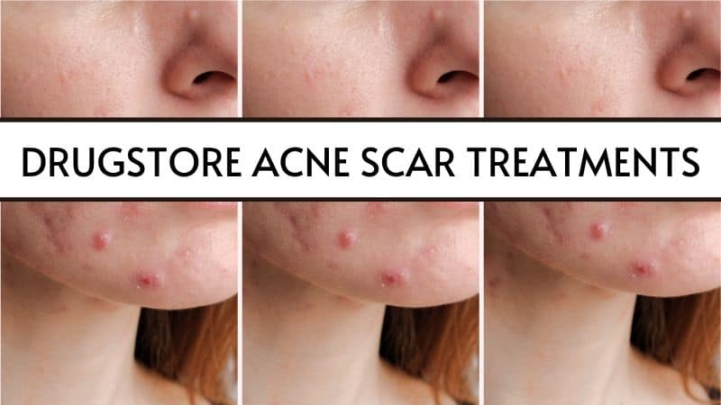 drugstore acne scar products