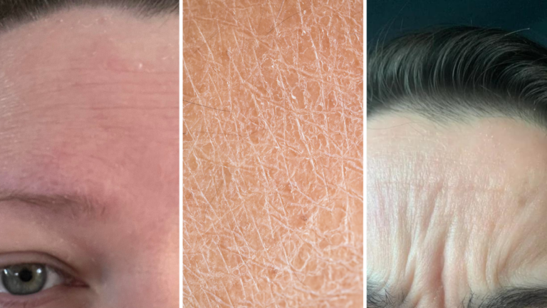 Why Does My Skin Feel Tight? Let’s Decode Why & What to Do Better