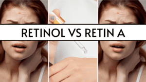featured image Retinol vs Retin A