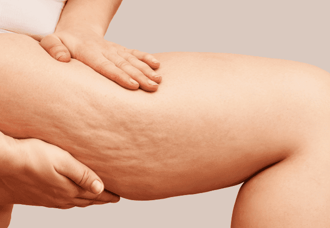 gua sha for cellulite thighs