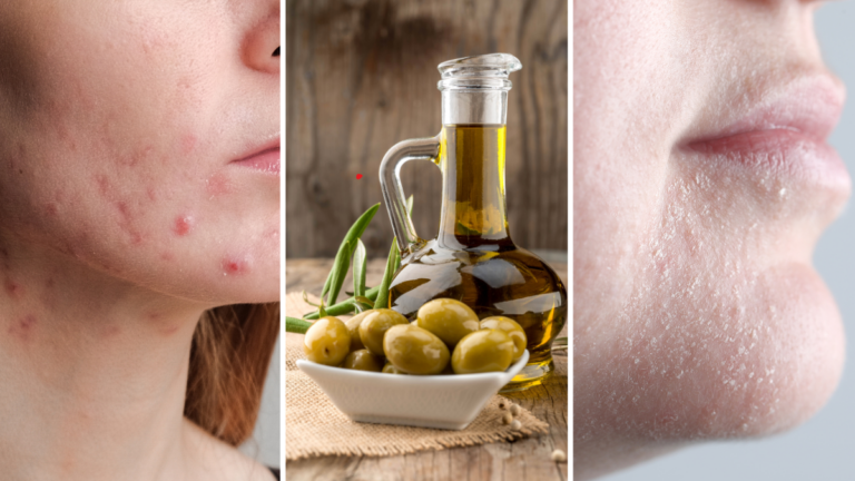 The Lowdown on Olive Oil: Is It a Skin Savior or a Sneaky Comedogenic Culprit?