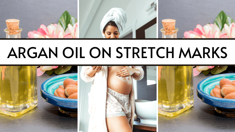 argan oil on stretch marks
