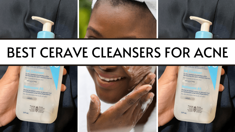 best cerave cleansers for acne