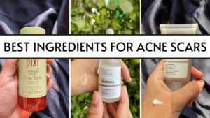 best ingredients for acne scars