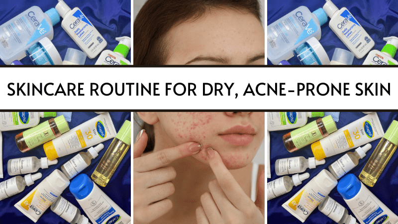 skincare routine for dry acne-prone skin