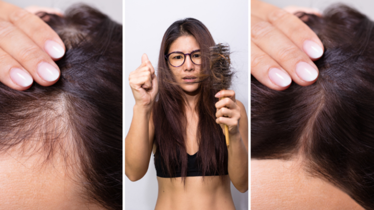 Does Stress Cause Hair Loss? How To Relax and Promote New Hair Growth!