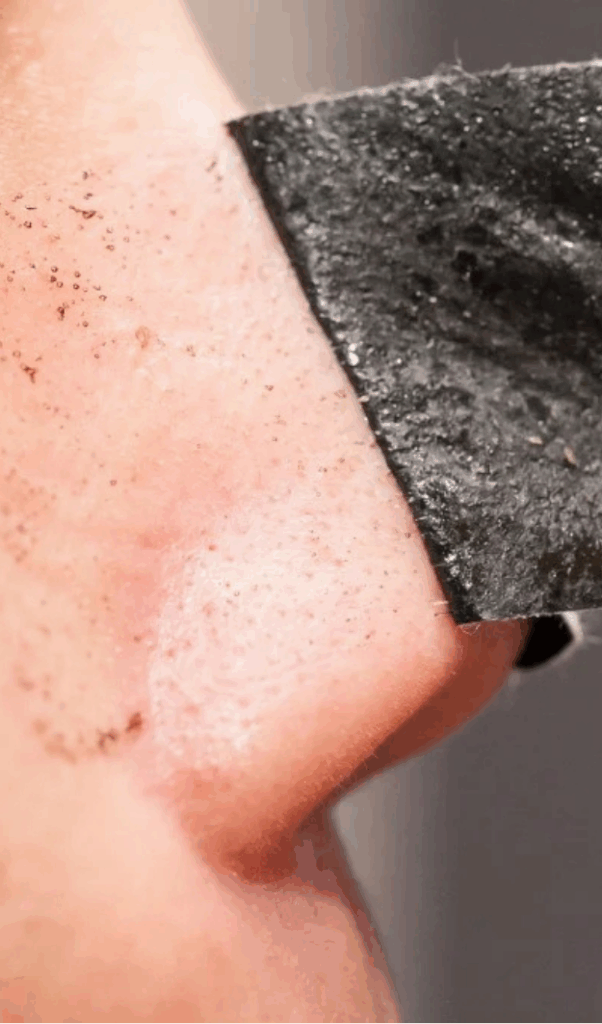 How to Get Rid of Blackheads (And 8 Things You Need to Stop Doing Immediately) How to Get Rid of Blackheads (And 8 Things You Need to Stop Doing Immediately)