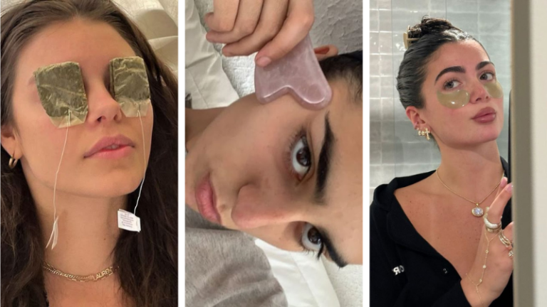 puffy eyes remedies