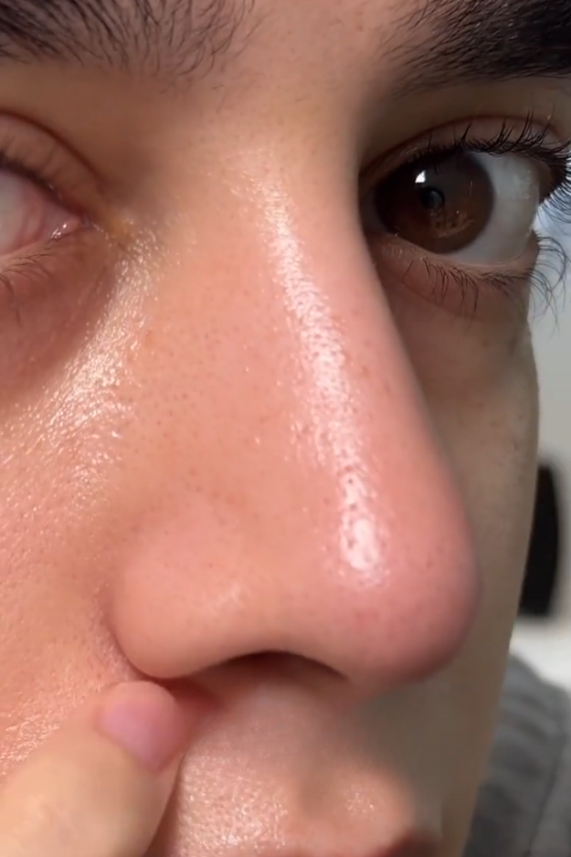 11 how to reduce open pores