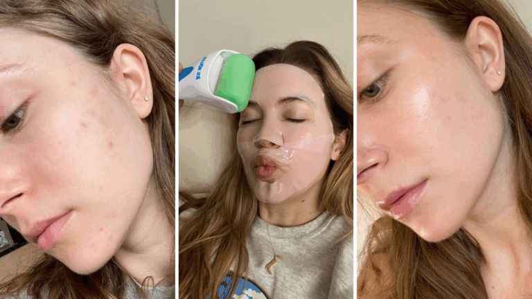 How to Reduce Open Pores Naturally (10 Proven Tips)